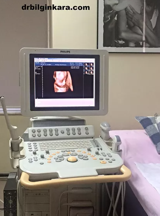 OP DR BİLGİN KARA